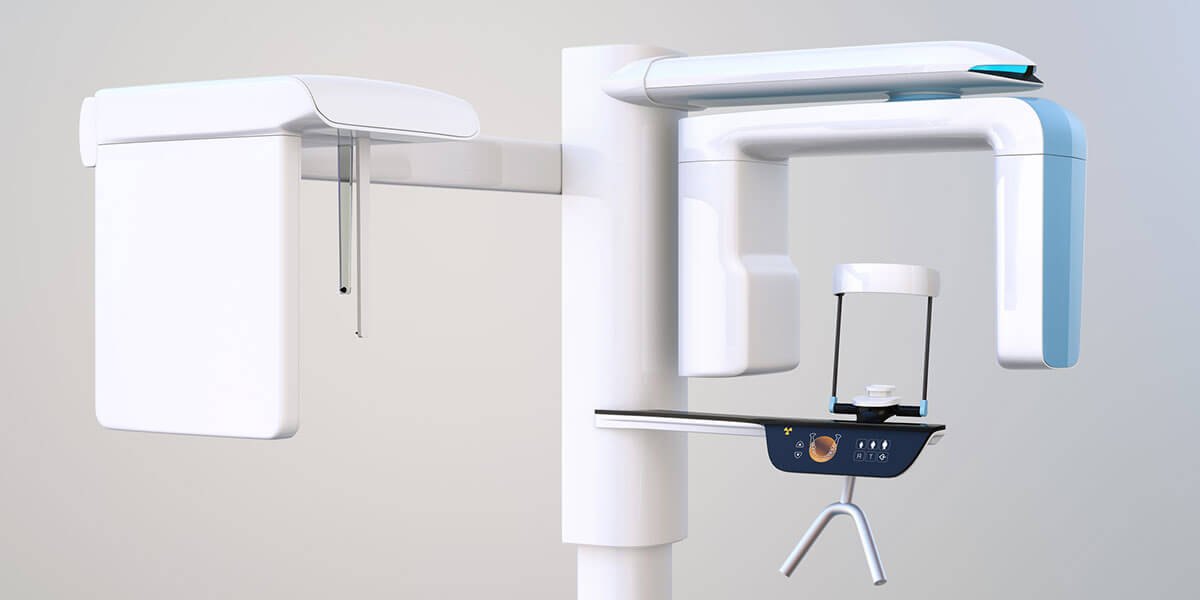 3D Cone Beam Scanner