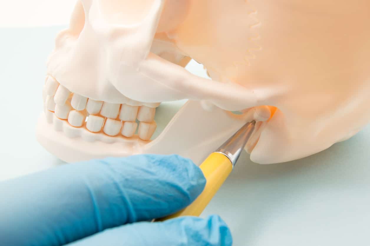 Dental implants illustration