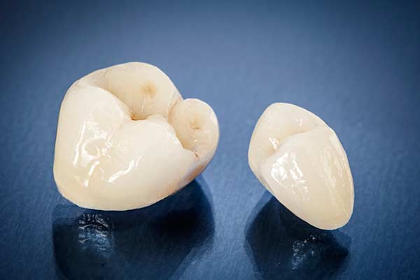 Porcelain crowns